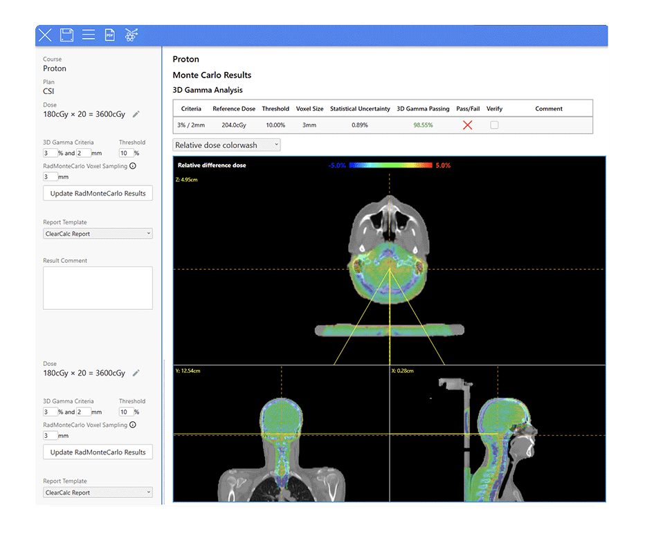 CNS_Proton_Plan-1 CNS_Proton_Plan-1