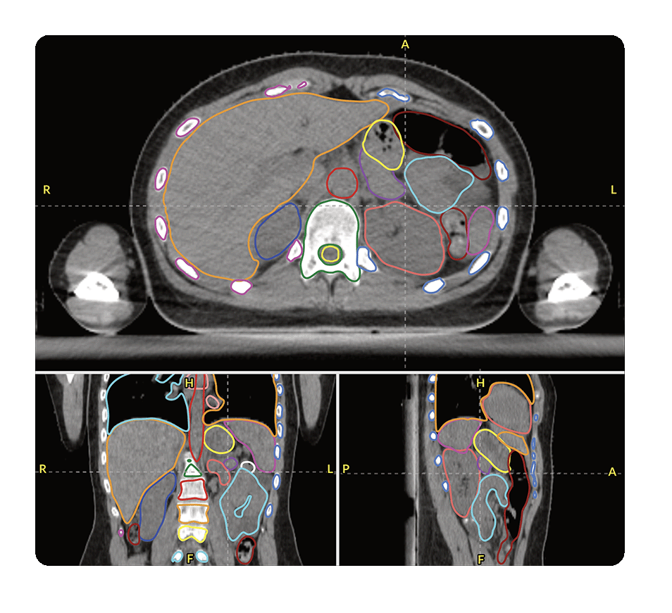 CT SCAN CT SCAN