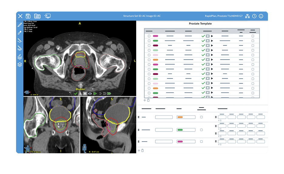 UI_AutoContour_SM UI_AutoContour_SM